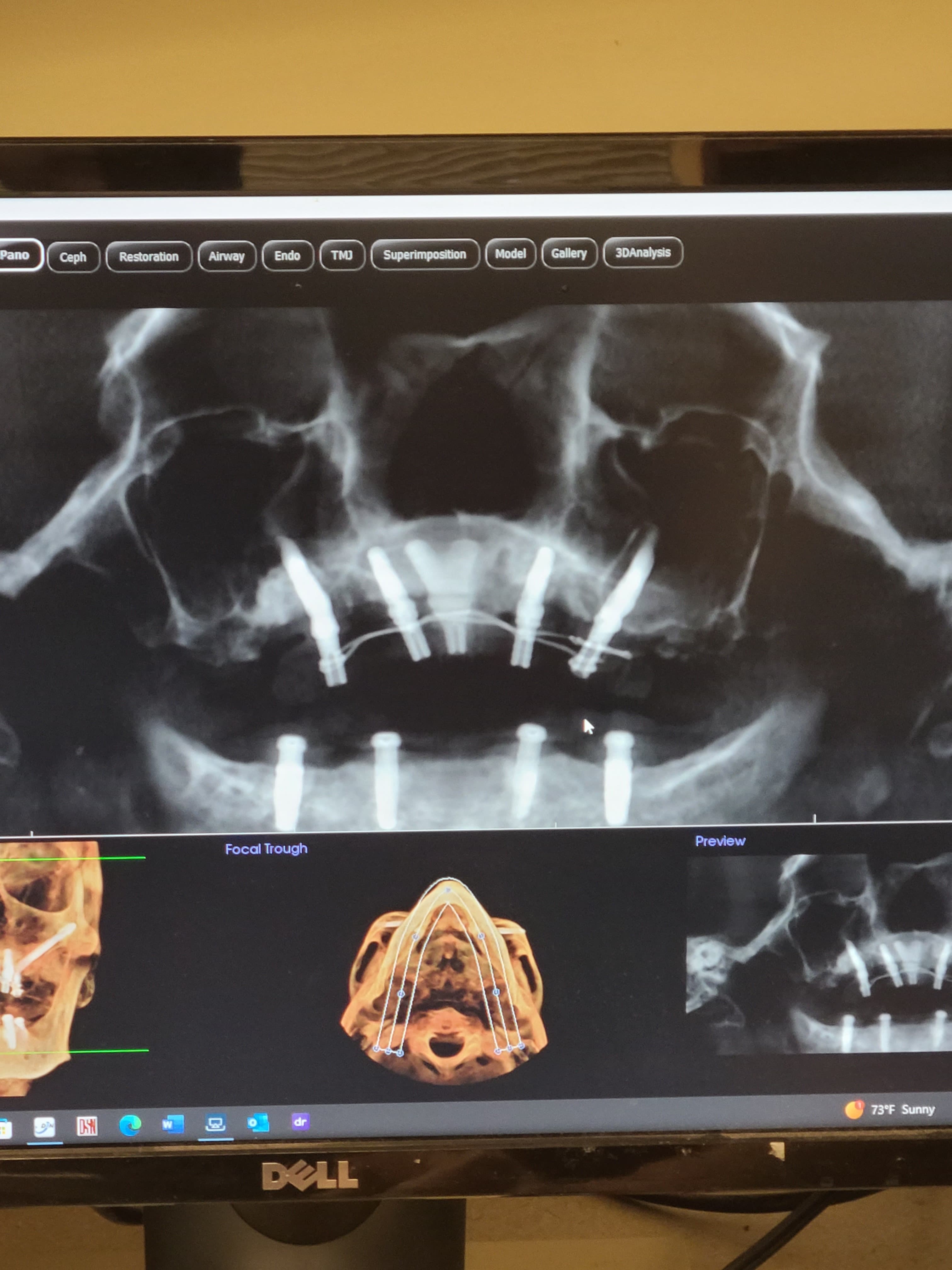 Digital dentistry workflow